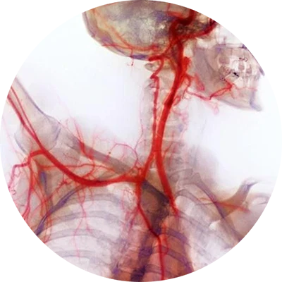 Vascular Support & Antioxidant Power